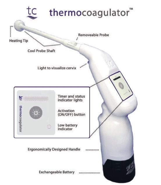 Thermocoagulator Diagram 2