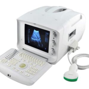 Anjue Ultrasound AJ 6100B 1