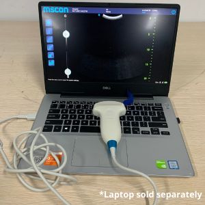 M SCAN B1 Probe 2 Probe with Laptop