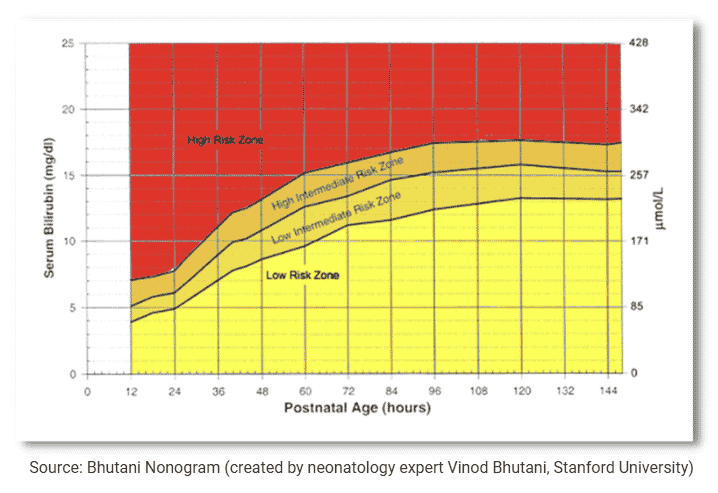 newborgn jaundice risk zone chart